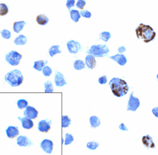 PDCD1 / CD279 / PD-1 Antibody - Immunocytochemistry of PD-1 in transfected 293 cells with PD-1 antibody at 5 ug/mL. Lower left: Immunocytochemistry in transfected 293 cells with control mouse IgG antibody at 5 ug/mL.
