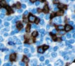 PDCD1 / CD279 / PD-1 Antibody - IHC of PD-1 on FFPE Tonsil tissue. This image was taken for the unmodified form of this product. Other forms have not been tested.