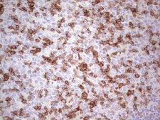 PDCD1 / CD279 / PD-1 Antibody - IHC of paraffin-embedded Human tonsil using anti-PDCD1 mouse monoclonal antibody. (Heat-induced epitope retrieval by 1 mM EDTA in 10mM Tris, pH8.5, 120°C for 3min).