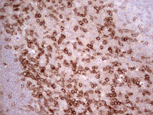 PDCD1 / CD279 / PD-1 Antibody - Immunohistochemical staining of paraffin-embedded Human tonsil using anti-PDCD1 mouse monoclonal antibody. (Heat-induced epitope retrieval by Tris-EDTA, pH8.0)(1:150)