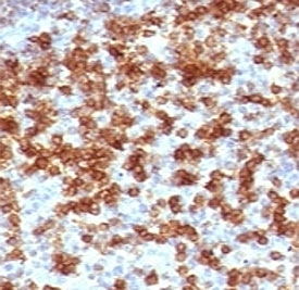 PDCD1 / CD279 / PD-1 Antibody - IHC testing of FFPE human tonsil stained with anti-PD-1 antibody (clone PD203-1).  This image was taken for the unmodified form of this product. Other forms have not been tested.