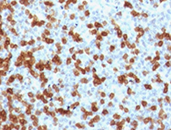 PDCD1 / CD279 / PD-1 Antibody - IHC testing of FFPE human tonsil with PD-1 antibody (clone RMPD1-1).  This image was taken for the unmodified form of this product. Other forms have not been tested.