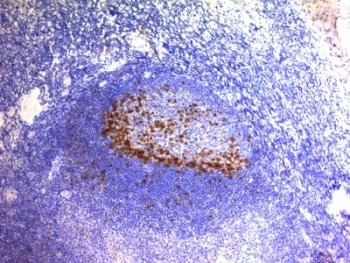 PDCD1 / CD279 / PD-1 Antibody - Formalin-fixed, paraffin-embedded human tonsil stained with PD1 antibody (SPM597).  This image was taken for the unmodified form of this product. Other forms have not been tested.