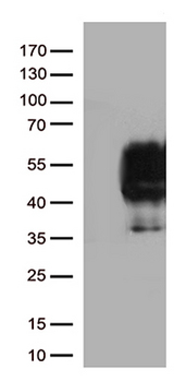 PDCD1 / CD279 / PD-1 Antibody - HEK293T cells were transfected with the pCMV6-ENTRY control. (Left lane) or pCMV6-ENTRY PDCD1. (Right lane) cDNA for 48 hrs and lysed. Equivalent amounts of cell lysates. (5 ug per lane) were separated by SDS-PAGE and immunoblotted with anti-PDCD1 antibody. (1:2000)