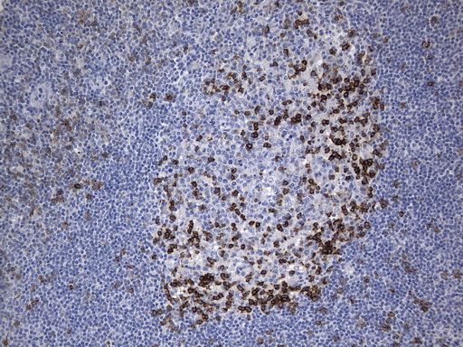 PDCD1 / CD279 / PD-1 Antibody - Immunohistochemical staining of paraffin-embedded Human tonsil using anti-PDCD1 mouse monoclonal antibody. (Heat-induced epitope retrieval by 1mM EDTA in 10mM Tris buffer. (pH8.0) at 120C for 3 min. (1:200)