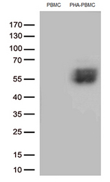 PDCD1 / CD279 / PD-1 Antibody - Western blot analysis of extracts. (35ug) from PBMCs and PHA-stimulated-PBMCs by using anti-PDCD1 monoclonal antibody. (1:250)