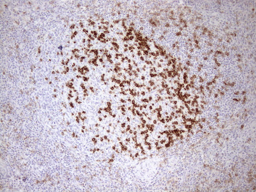PDCD1 / CD279 / PD-1 Antibody - Immunohistochemical staining of paraffin-embedded Human tonsil using anti-PDCD1 mouse monoclonal antibody. (Heat-induced epitope retrieval by 1mM EDTA in 10mM Tris buffer. (pH8.5) at 110C for 10 min. (1:1200)