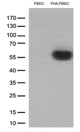 PDCD1 / CD279 / PD-1 Antibody - Western blot analysis of extracts. (35ug) from PBMCs and PHA-stimulated-PBMCs by using anti-PDCD1 monoclonal antibody. (1:250)