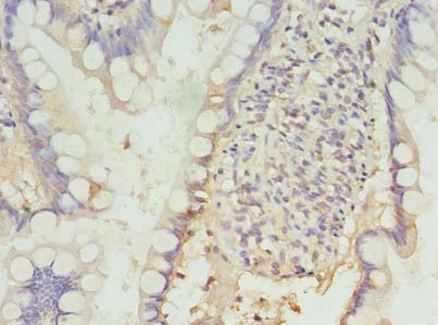 PDCD1 / CD279 / PD-1 Antibody - Immunohistochemistry of paraffin-embedded human small intestine using antibody at dilution of 1:100.