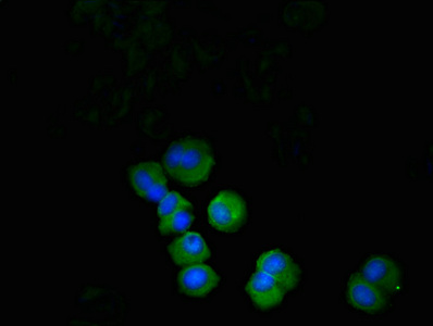 PDCD1 / CD279 / PD-1 Antibody - Immunofluorescent analysis of MCF-7 cells using PDCD1 Antibody at dilution of 1: 100 and Alexa Fluor 488-congugated AffiniPure Goat Anti-Rabbit IgG(H+L)