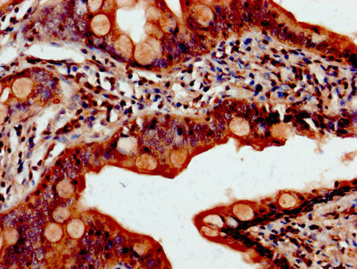 PDCD10 Antibody - IHC image of PDCD10 Antibody diluted at 1:800 and staining in paraffin-embedded human small intestine tissue performed on a Leica BondTM system. After dewaxing and hydration, antigen retrieval was mediated by high pressure in a citrate buffer (pH 6.0). Section was blocked with 10% normal goat serum 30min at RT. Then primary antibody (1% BSA) was incubated at 4°C overnight. The primary is detected by a biotinylated secondary antibody and visualized using an HRP conjugated SP system.