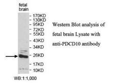 PDCD10 Antibody - Western blot of PDCD10 antibody