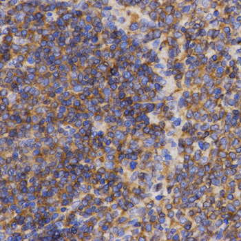 PDCD10 Antibody - Immunohistochemistry of paraffin-embedded rat spleen tissue.