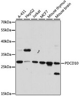 PDCD10 Antibody - Western blot analysis of extracts of various cell lines, using PDCD10 antibody at 1:1000 dilution. The secondary antibody used was an HRP Goat Anti-Rabbit IgG (H+L) at 1:10000 dilution. Lysates were loaded 25ug per lane and 3% nonfat dry milk in TBST was used for blocking. An ECL Kit was used for detection and the exposure time was 90s.