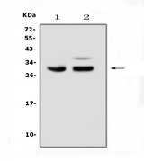 PDCD10 Antibody - Western blot analysis of PDCD10 using anti-PDCD10 antibody. Electrophoresis was performed on a 5-20% SDS-PAGE gel at 70V (Stacking gel) / 90V (Resolving gel) for 2-3 hours. The sample well of each lane was loaded with 50ug of sample under reducing conditions. Lane 1: rat smooth muscle tissue lysates, Lane 2: mouse smooth muscle tissue lysates. After Electrophoresis, proteins were transferred to a Nitrocellulose membrane at 150mA for 50-90 minutes. Blocked the membrane with 5% Non-fat Milk/ TBS for 1.5 hour at RT. The membrane was incubated with rabbit anti-PDCD10 antigen affinity purified polyclonal antibody at 0.5 ?g/mL overnight at 4?C, then washed with TBS-0.1% Tween 3 times with 5 minutes each and probed with a goat anti-rabbit IgG-HRP secondary antibody at a dilution of 1:10000 for 1.5 hour at RT. The signal is developed using an Enhanced Chemiluminescent detection (ECL) kit with Tanon 5200 system. A specific band was detected for PDCD10 at approximately 29KD. The expected band size for PDCD10 is at 25KD.
