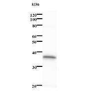 PDCD11 Antibody - Western blot analysis of immunized recombinant protein, using anti-PDCD11 monoclonal antibody.