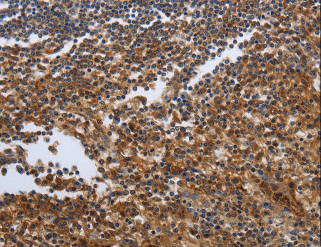 PDCD2 Antibody - Immunohistochemistry of paraffin-embedded Human tonsil using PDCD2 Polyclonal Antibody at dilution of 1:50.