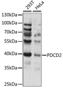 PDCD2 Antibody - Western blot analysis of extracts of various cell lines, using PDCD2 antibody at 1:1000 dilution. The secondary antibody used was an HRP Goat Anti-Rabbit IgG (H+L) at 1:10000 dilution. Lysates were loaded 25ug per lane and 3% nonfat dry milk in TBST was used for blocking. An ECL Kit was used for detection and the exposure time was 30s.