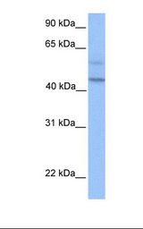PDCD2L Antibody - Hela cell lysate. Antibody concentration: 1.0 ug/ml. Gel concentration: 12%.  This image was taken for the unconjugated form of this product. Other forms have not been tested.