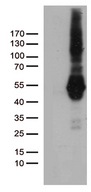 PDCD2L Antibody - HEK293T cells were transfected with the pCMV6-ENTRY control. (Left lane) or pCMV6-ENTRY PDCD2L. (Right lane) cDNA for 48 hrs and lysed