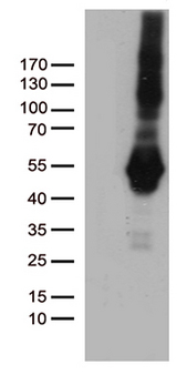 PDCD2L Antibody - HEK293T cells were transfected with the pCMV6-ENTRY control. (Left lane) or pCMV6-ENTRY PDCD2L. (Right lane) cDNA for 48 hrs and lysed. Equivalent amounts of cell lysates. (5 ug per lane) were separated by SDS-PAGE and immunoblotted with anti-PDCD2L. (1:500)