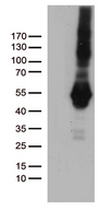 PDCD2L Antibody - HEK293T cells were transfected with the pCMV6-ENTRY control. (Left lane) or pCMV6-ENTRY PDCD2L. (Right lane) cDNA for 48 hrs and lysed. Equivalent amounts of cell lysates. (5 ug per lane) were separated by SDS-PAGE and immunoblotted with anti-PDCD2L. (1:500)