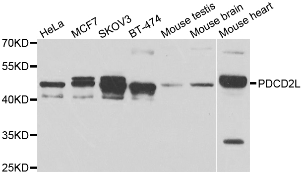 PDCD2L Antibody - Western blot analysis of extracts of various cell lines.