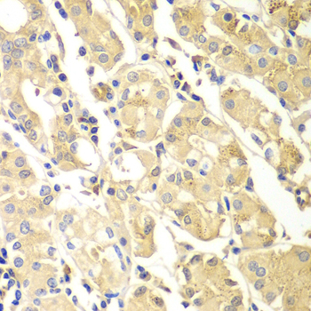 PDCD2L Antibody - Immunohistochemistry of paraffin-embedded human gastric tissue.