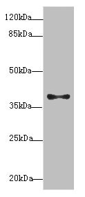 PDCD2L Antibody - Western blot All Lanes: PDCD2Lantibody at 1.4ug/ml+ MCF7 whole cell lysate Goat polyclonal to rabbit at 1/10000 dilution Predicted band size: 39 kDa Observed band size: 39 kDa