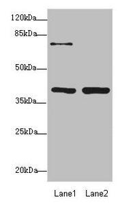 PDCD2L Antibody - Western blot All Lanes: PDCD2Lantibody at 1.69ug/ml Lane 1: Hela whole cell lysate Lane 2: MCF7 whole cell lysate Secondary Goat polyclonal to Rabbit IgG at 1/10000 dilution Predicted band size: 39 kDa Observed band size: 39 kDa,70kDa