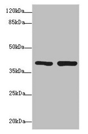 PDCD2L Antibody - Western blot All lanes: PDCD2L antibody at 1.69µg/ml Lane 1: Hela whole cell lysate Lane 2: MCF-7 whole cell lysate Secondary Goat polyclonal to rabbit IgG at 1/10000 dilution Predicted band size: 39 kDa Observed band size: 39 kDa