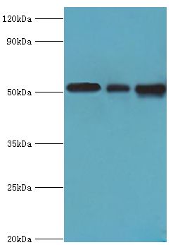 PDCD4 Antibody - Western blot. All lanes: Programmed cell death protein 4 antibody at 5 ug/ml. Lane 1: HeLa whole cell lysate. Lane 2: MCF-7 whole cell lysate. Lane 3: Jurkat whole cell lysate. secondary Goat polyclonal to rabbit at 1:10000 dilution. Predicted band size: 52 kDa. Observed band size: 52 kDa.