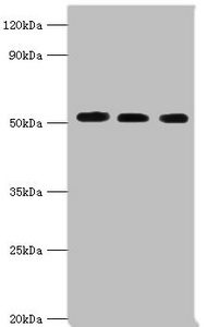 PDCD4 Antibody - Western blot All lanes: Programmed cell death protein 4 antibody at 5µg/ml Lane 1: Hela whole cell lysate Lane 2: MCF-7 whole cell lysate Lane 3: Jurkat whole cell lysate Secondary Goat polyclonal to rabbit IgG at 1/10000 dilution Predicted band size: 52, 51 kDa Observed band size: 52 kDa