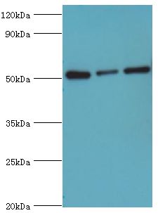PDCD4 Antibody - Western blot. All lanes: Programmed cell death protein 4 antibody at 4 ug/ml. Lane 1: HeLa whole cell lysate. Lane 2: MCF-7 whole cell lysate. Lane 3: Jurkat whole cell lysate. secondary Goat polyclonal to rabbit at 1:10000 dilution. Predicted band size: 52 kDa. Observed band size: 52 kDa.