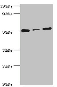PDCD4 Antibody - Western blot All lanes: Programmed cell death protein 4 antibody at 4µg/ml Lane 1: Hela whole cell lysate Lane 2: MCF-7 whole cell lysate Lane 3: Jurkat whole cell lysate Secondary Goat polyclonal to rabbit IgG at 1/10000 dilution Predicted band size: 52, 51 kDa Observed band size: 52 kDa