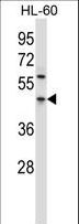 PDCD4 Antibody - PDCD4 Antibody western blot of HL-60 cell line lysates (35 ug/lane). The PDCD4 antibody detected the PDCD4 protein (arrow).