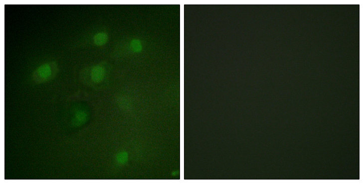 PDCD4 Antibody - Immunofluorescence analysis of HeLa cells, using PDCD4 Antibody. The picture on the right is blocked with the synthesized peptide.