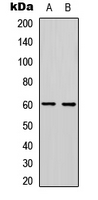 PDCD4 Antibody - Western blot analysis of PDCD4 (pS457) expression in HeLa (A); Jurkat (B) whole cell lysates.