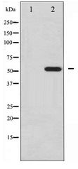 PDCD4 Antibody - Western blot of PDCD4 expression in 293 whole cell lysates,The lane on the left is treated with the antigen-specific peptide.