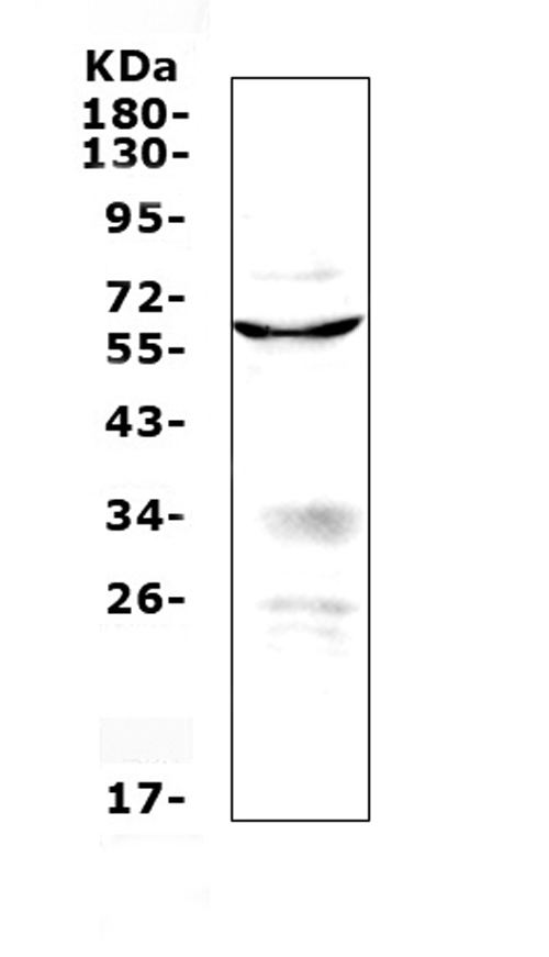 PDCD4 Antibody - Western blot analysis of PDCD4 using anti-PDCD4 antibody. Electrophoresis was performed on a 5-20% SDS-PAGE gel at 70V (Stacking gel) / 90V (Resolving gel) for 2-3 hours. The sample well of each lane was loaded with 50ug of sample under reducing conditions. Lane 1: mouse ovary tissue lysate. After Electrophoresis, proteins were transferred to a Nitrocellulose membrane at 150mA for 50-90 minutes. Blocked the membrane with 5% Non-fat Milk/ TBS for 1.5 hour at RT. The membrane was incubated with rabbit anti-PDCD4 antigen affinity purified polyclonal antibody at 0.5 µg/mL overnight at 4°C, then washed with TBS-0.1% Tween 3 times with 5 minutes each and probed with a goat anti-rabbit IgG-HRP secondary antibody at a dilution of 1:10000 for 1.5 hour at RT. The signal is developed using an Enhanced Chemiluminescent detection (ECL) kit with Tanon 5200 system. A specific band was detected for PDCD4 at approximately 60KD. The expected band size for PDCD4 is at 52KD.