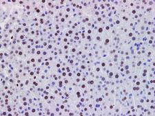 PDCD4 Antibody - Immunohistochemistry of paraffin-embedded Mouse liver using PDCD4 Polyclonal Antibody at dilution of 1:200.