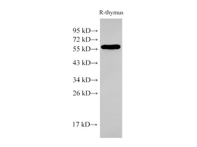 PDCD4 Antibody - Western Blot analysis of Rat thymus cells using PDCD4 Polyclonal Antibody at dilution of 1:500.