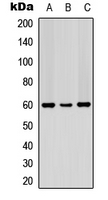 PDCD4 Antibody - Western blot analysis of PDCD4 (pS67) expression in K562 (A); Jurkat (B); HeLa (C) whole cell lysates.