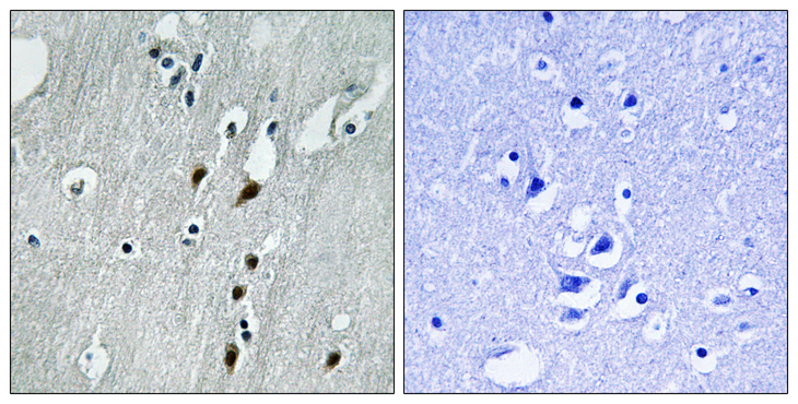 PDCD4 Antibody - Immunohistochemistry analysis of paraffin-embedded human brain, using PDCD4 (Phospho-Ser457) Antibody. The picture on the right is blocked with the phospho peptide.