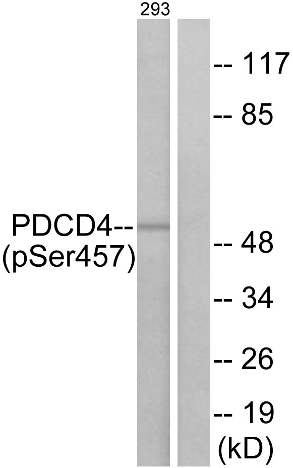 PDCD4 Antibody - Western blot analysis of lysates from 293 cells treated with serum 20% 15', using PDCD4 (Phospho-Ser457) Antibody. The lane on the right is blocked with the phospho peptide.