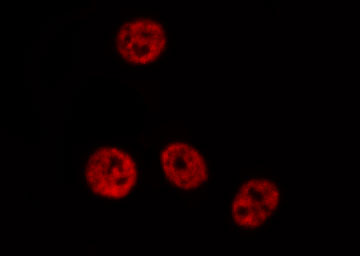 PDCD4 Antibody - Staining HepG2 cells by IF/ICC. The samples were fixed with PFA and permeabilized in 0.1% Triton X-100, then blocked in 10% serum for 45 min at 25°C. The primary antibody was diluted at 1:200 and incubated with the sample for 1 hour at 37°C. An Alexa Fluor 594 conjugated goat anti-rabbit IgG (H+L) Ab, diluted at 1/600, was used as the secondary antibody.