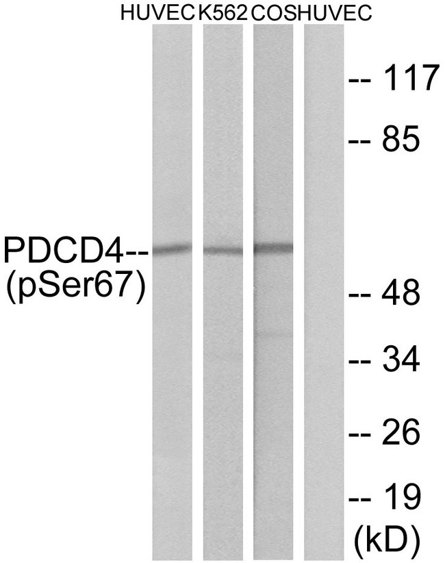 PDCD4 Antibody - Western blot analysis of lysates from HUVEC cells, K562 cells and COS-7 cells, using PDCD4 (Phospho-Ser67) Antibody. The lane on the right is blocked with the phospho peptide.