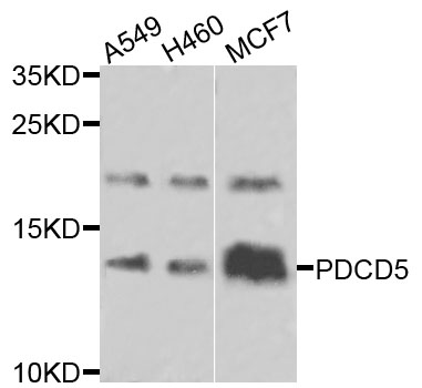 PDCD5 Antibody - Western blot analysis of extracts of various cells.