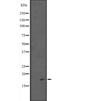 PDCD5 Antibody - Western blot analysis of PDCD5 expression in EL4 cells lysate. The lane on the left is treated with the antigen-specific peptide.
