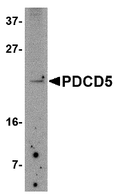 PDCD5 Antibody - Western blot of PDCD5 in Jurkat cell lysate with PDCD5 antibody at 2.5 ug/ml
